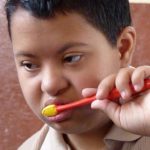 Cepillado dental en niños con síndrome de Down 
